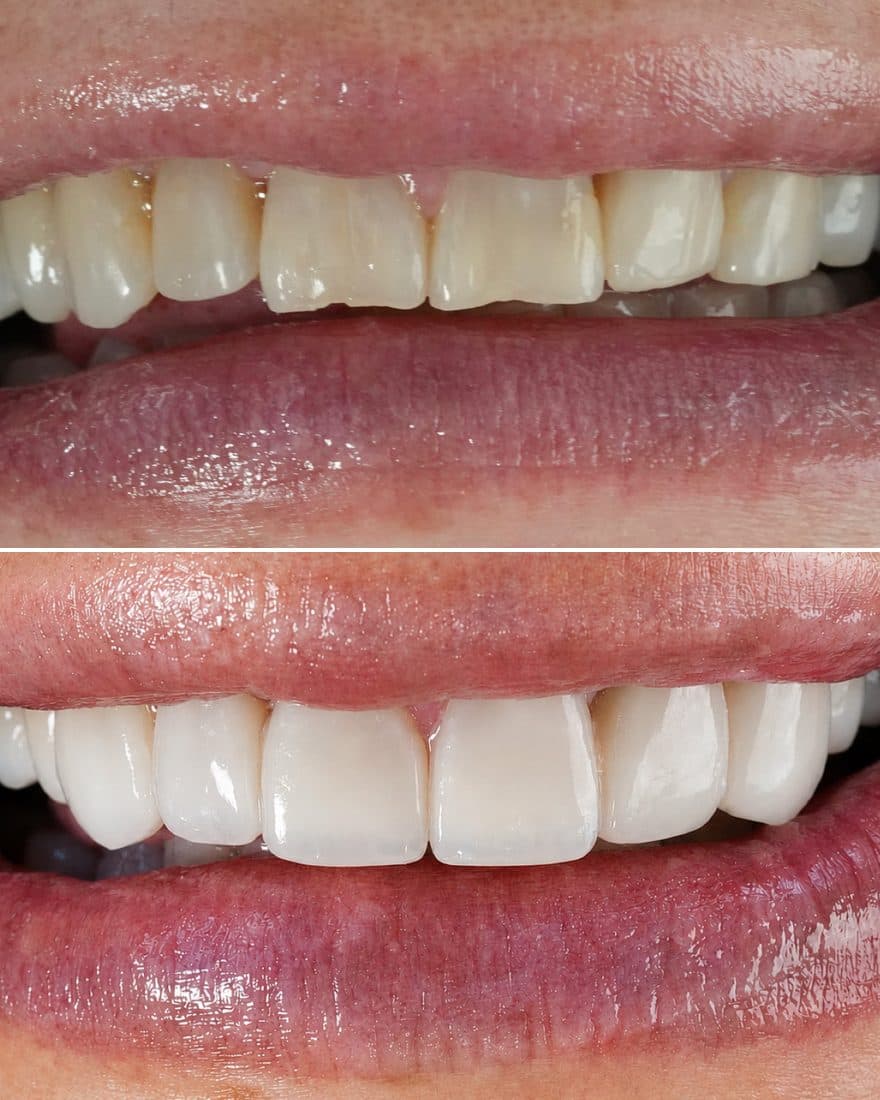 Rehabilitación oral